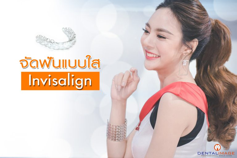 invisalign