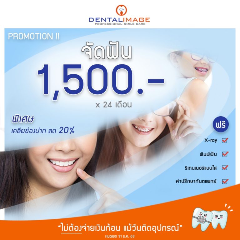 โปรโมชั่นจัดฟัน