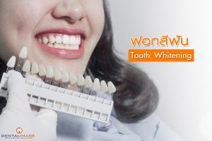 ฟอกสีฟัน