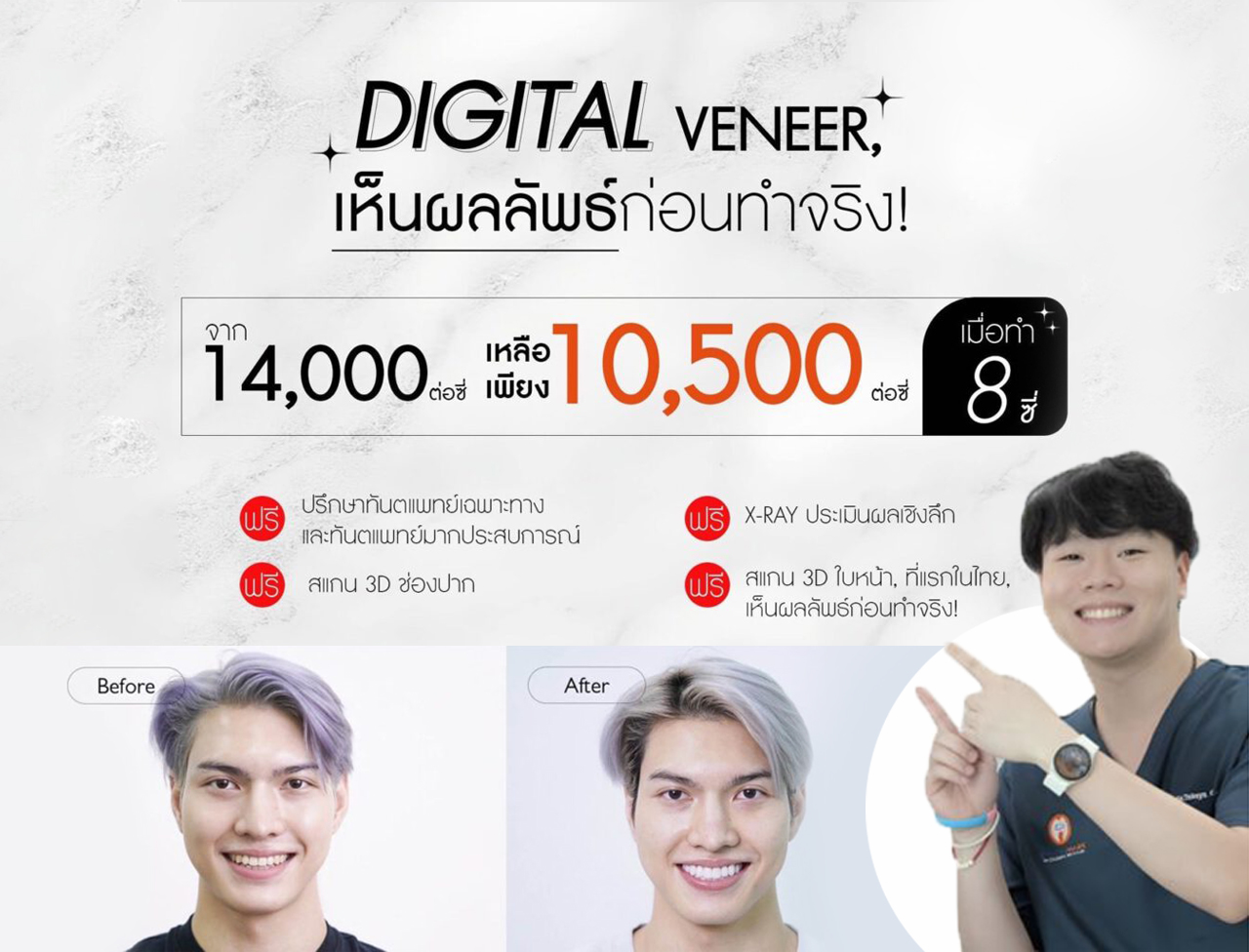 โปรโมชั่น Digital Veneer