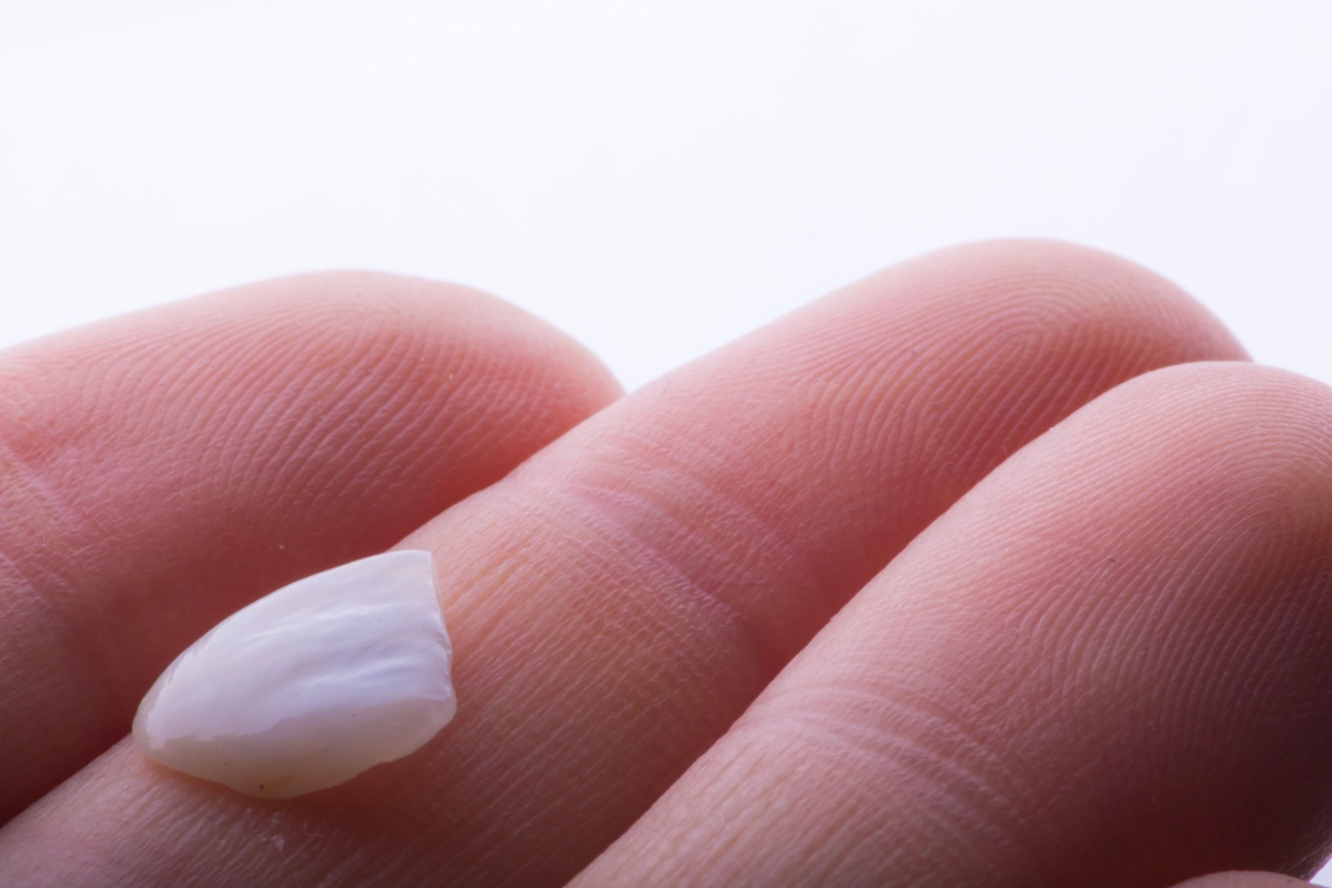 วีเนียร์หลุด วีเนียร์แตก ทำอย่างไร? วิธีแก้ปัญหาเฉพาะหน้าและสาเหตุที่ทำให้วีเนียร์เสียหาย