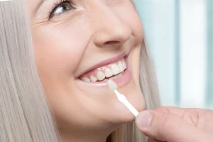 ทำวีเนียร์อยู่ได้กี่ปี? 5 เคล็ดลับดูแลวีเนียร์ให้สวยทนทาน ไม่หลุด ไม่บิ่น ง่ายๆ ด้วยตัวเอง