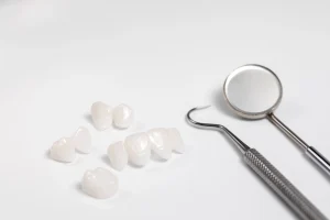 ต้องเปลี่ยนวีเนียร์เซรามิกทุกกี่ปี? สัญญาณเตือนว่าถึงเวลาต้องทำชิ้นใหม่