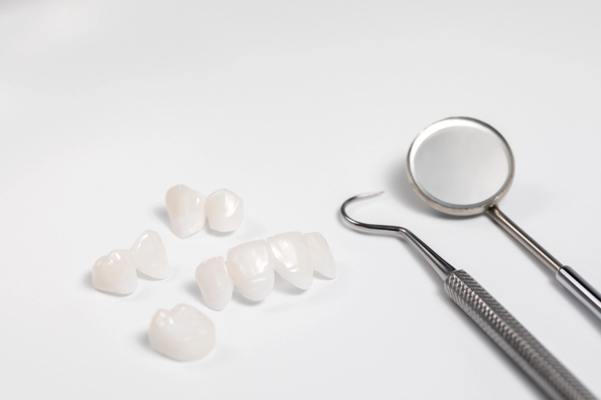 ต้องเปลี่ยนวีเนียร์เซรามิกทุกกี่ปี? สัญญาณเตือนว่าถึงเวลาต้องทำชิ้นใหม่