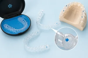 Invisalign Teen กับฟังก์ชัน Compliance Indicators (จุดสีฟ้าเช็กวินัย) ช่วยคุณพ่อคุณแม่มอนิเตอร์ลูกได้อย่างไร